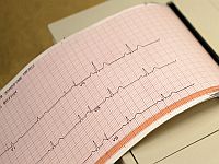 Самовосстановление человеческого сердца: исследование скрытой способности