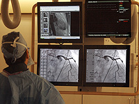 ИИ обнаруживает проблемы с сердцем до того, как у людей появятся симптомы