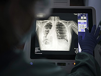 Почему смертельные заболевания сердца диагностируются у мужчин чаще, чем у женщин