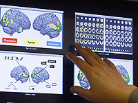 Исследователи связывают задержку развития мозга с расстройством пищевого поведения