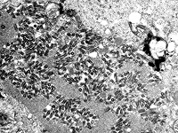 ИИ выявляет активность генов в клетках человека