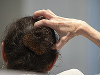 Почему приятно и полезно почесать зудящее место. Результаты исследования