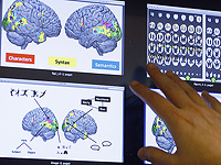 В тканях мозга человека выявлено тревожащее содержание микропластика