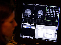 Половые различия в структуре мозга присутствуют при рождении