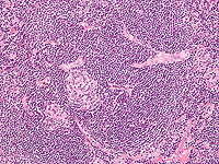 Пациент с неизлечимой болезнью 