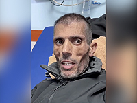 В соцсетях обсуждают истощенного 