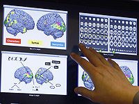 Ученые выявили половые различия в реакции мозга на стресс