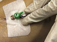 Умер мужчина, чья кровь спасла 2,4 миллиона младенцев