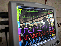 Благосостояние и образование играют важную роль в риске сердечных заболеваний