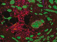 Израильские ученые заставили раковые клетки выдавать себя иммунной системе