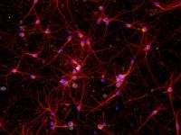 ИИ помогает понять, как клетки реагируют на лекарства