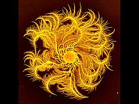 Обнаруженная в почве молекула может бороться с бактериями, устойчивыми к лекарствам