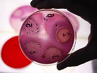 Израильские ученые описали новый механизм, который используют бактерии для защиты от антибиотиков