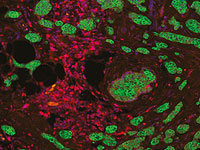 Ген-переключатель превращает иммунные клетки в уничтожителей рака