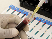 Израильский стартап OncoRedox разрабатывает диагностику колоректального рака по капле крови