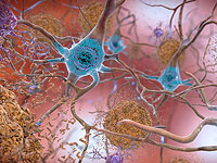 Эмпатия может сохраняться при болезни Альцгеймера