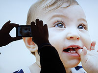 Фотографии глаз, сделанные с помощью смартфона, могут помочь обнаружить анемию у детей