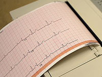 Израильские ученые научили ИИ читать электрокардиограммы и разъяснять диагноз
