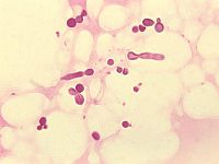 Грибки, обитающие на коже человека, могут стать источником новых антибиотиков