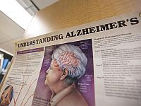 Ученые используют живую мозговую ткань человека, чтобы ускорить поиски лекарства от слабоумия