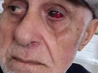 Внимание, розыск: пропал 83-летний Давидсон Барнов, из Кирьят-Моцкина