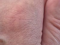 Новое устройство контролирует здоровье, определяя газы, проходящие через кожу