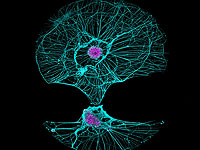 Как нейроны выживают после воздействия нейротоксинов