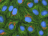 На поздней стадии рака иммунные клетки не атакуют опухоль, а защищают. Израильское исследование