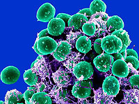 Особые наноповерхности усиливают модифицированные иммунные клетки для лечения рака