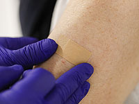 Израильские ученые создали биоинженерную кожу, она вдвое ускоряет заживление после ожогов