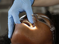 Микрофлора полости рта может быть связана с диагностикой и лечением депрессии