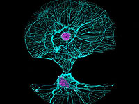 Ученые показали, как сохранные нейроны берут на себя функции умерших