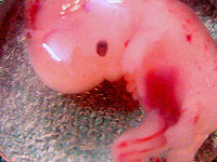 Эмбрионы могут уничтожать бактерии до формирования иммунной системы