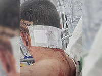 Спор о войне в Украине завершился поножовщиной на стройплощадке в Холоне