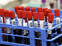 Толерантность к глюкозе может быть связана с продолжительностью жизни