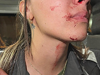 Во время разгона акции протеста на въезде в Иерусалим ранена полицейская