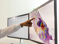 Израильский стартап разрабатывает технологию быстрой персонифицированной диагностики рака