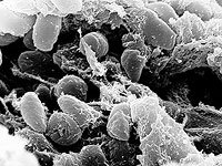 Израильские ученые разработали вакцину от 