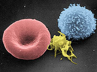 Анализ крови без крови: технология отслеживает уровень натрия без единой иглы