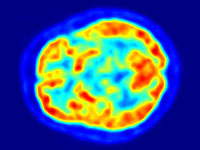 У оптимистов наблюдаются схожие паттерны работы мозга при мыслях о будущем