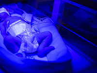 Самый недоношенный ребенок в мире отпраздновал первый день рождения