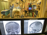 Пандемия COVID состарила мозг