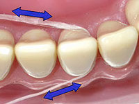 Новый вид зубной нити может заменить иглы для вакцин