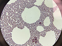 Бактерии создают калейдоскопические узоры и демонстрируют коллективное поведение