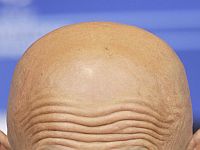 Новое лекарство от облысения создано испанскими учеными