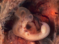 Микробы формируют раннее развитие мозга до и после рождения