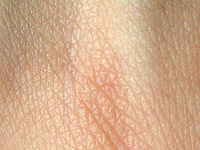 Температура кожи говорит о комфорте человека