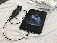 Врачи разработали стетоскоп с ИИ, который может обнаружить заболевания сердца за 15 секунд