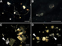 Нанопластик нарушает энергетический обмен веществ в клетках мозга