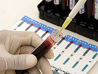 Израильтяне разработали метод персонифицированного анализа крови для подбора антидепрессантов